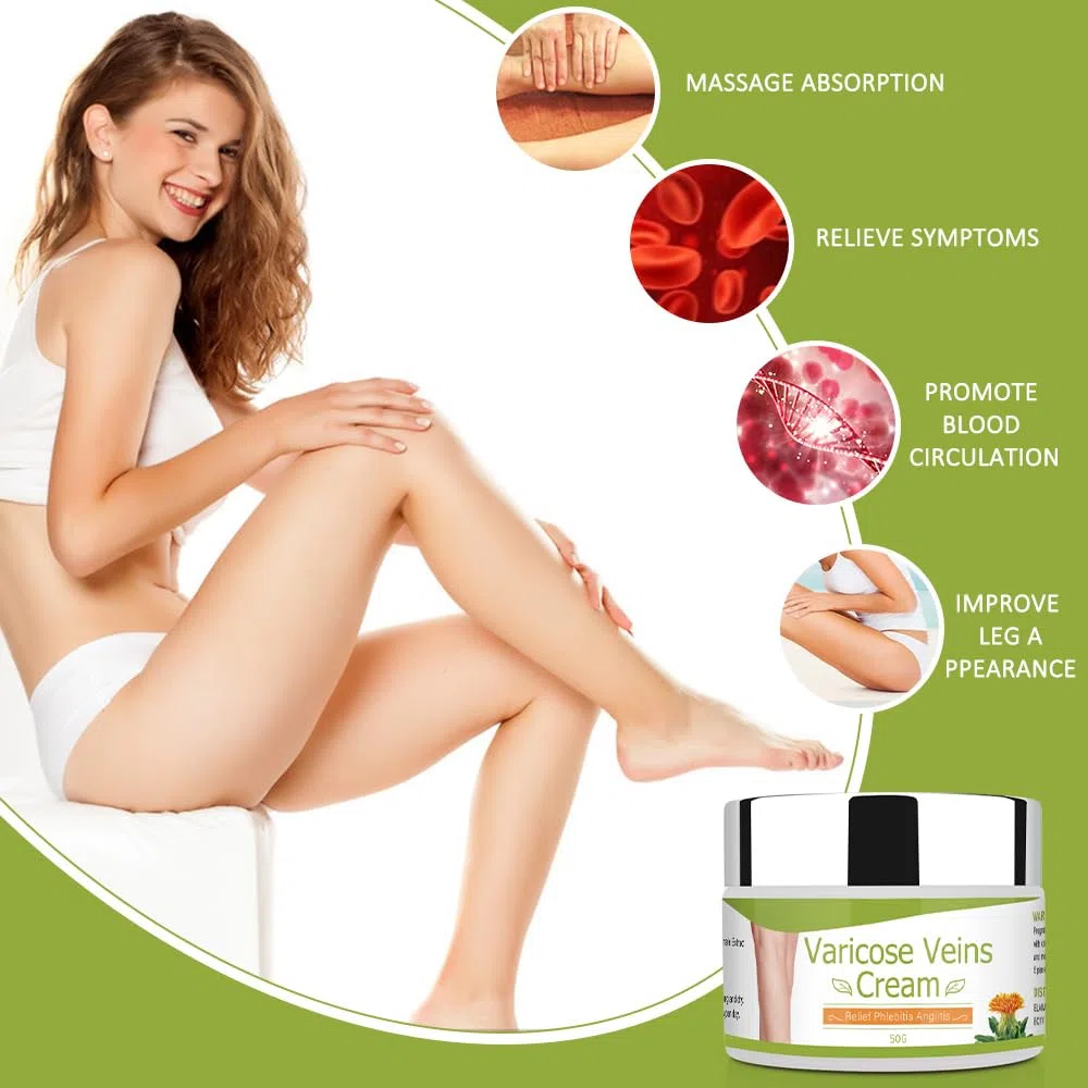 Crema para Varices 50G circulación sanguínea en las piernas, Crema para venas varicosas, alivio de flebitis, mejorar la inflamación de los vasos