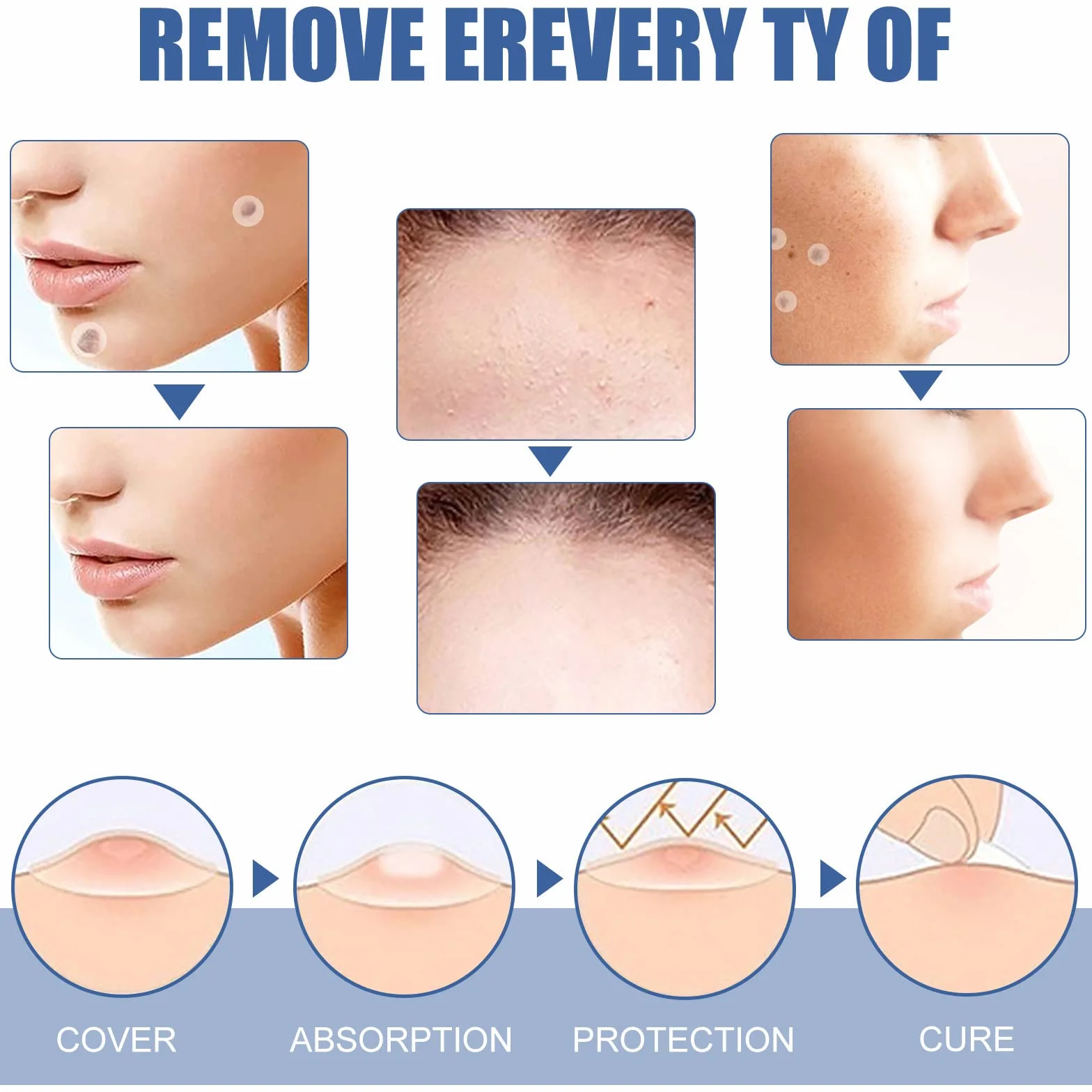 Wart and Mole Removal Patches,Parches Quita Verrugas Cuello y Cara,Producto de Verrugas,Skin Tag Removal Patches,Parches Quita Wart Cuello y Cara,para Mujer Hombre,144 Piezas
