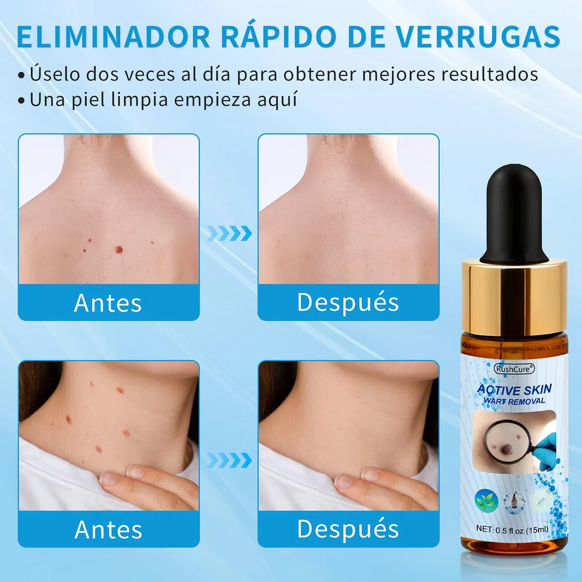 Acción para eliminar acrocordones – Pipeta de precisión para rostro y cuerpo | Eliminación específica de verrugas plantares, vulgares y planas | Fórmula suave con, Sin Dolor | Formato de viaje (15 ml)